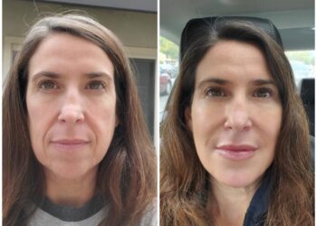 Unmatched Commitment to Patient Care at Eternia Medspa