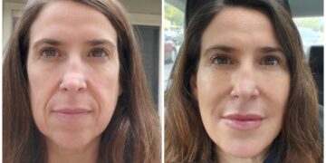 Unmatched Commitment to Patient Care at Eternia Medspa