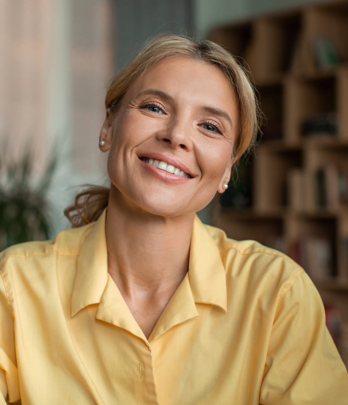 Patients moving on from filler can consider fat grafting or a lift.